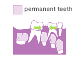 If a milk tooth is lost at an early stage, the teeth adjoining the milk teeth may move and reduce the space in which the permanent tooth can erupt.