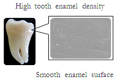 High tooth enamel density,Smooth enamel surface