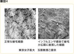 図4.線毛細胞