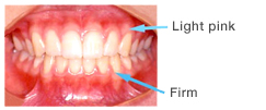 The gums are light pink and firm.