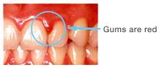 The gums are red in color.