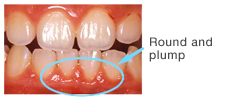 The gums are round and plump.