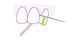 Move the floss up and down against the surface of the side of the tooth (both the right and left sides) 2 to 3 times, as if wrapping the floss around the tooth.