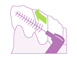 Slide the brush between two teeth at an angle with the bristles facing away from the gums, so as not to damage the gums.