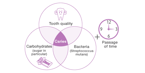 Caries is caused by the tooth quality, carbohydrates and bacteria.
